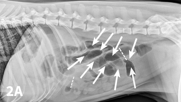 Top 5 Tips on Radiographic Diagnosis of Obstructive Foreign Bodies